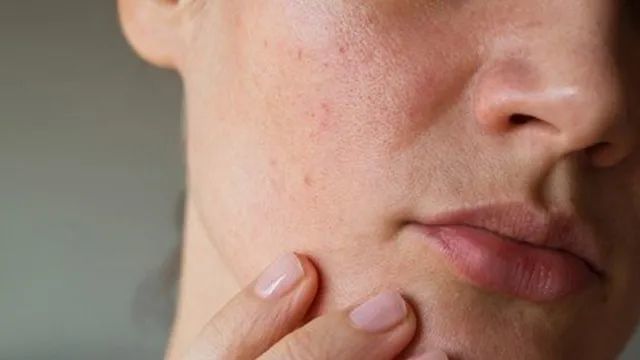 深圳肤康皮肤病专科提醒:春季会诱发这类皮肤病 预防是关键!