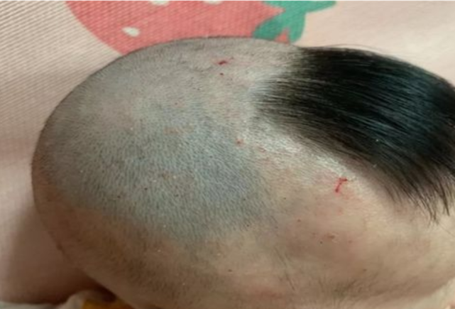 以上这3种情况不适合宝宝去理发剃头,妈妈要多注意.