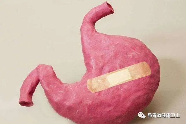 胆汁反流性胃炎|胃脘灼痛，嗳气反酸，胆汁反流性胃炎，服药四周，诸证悉除