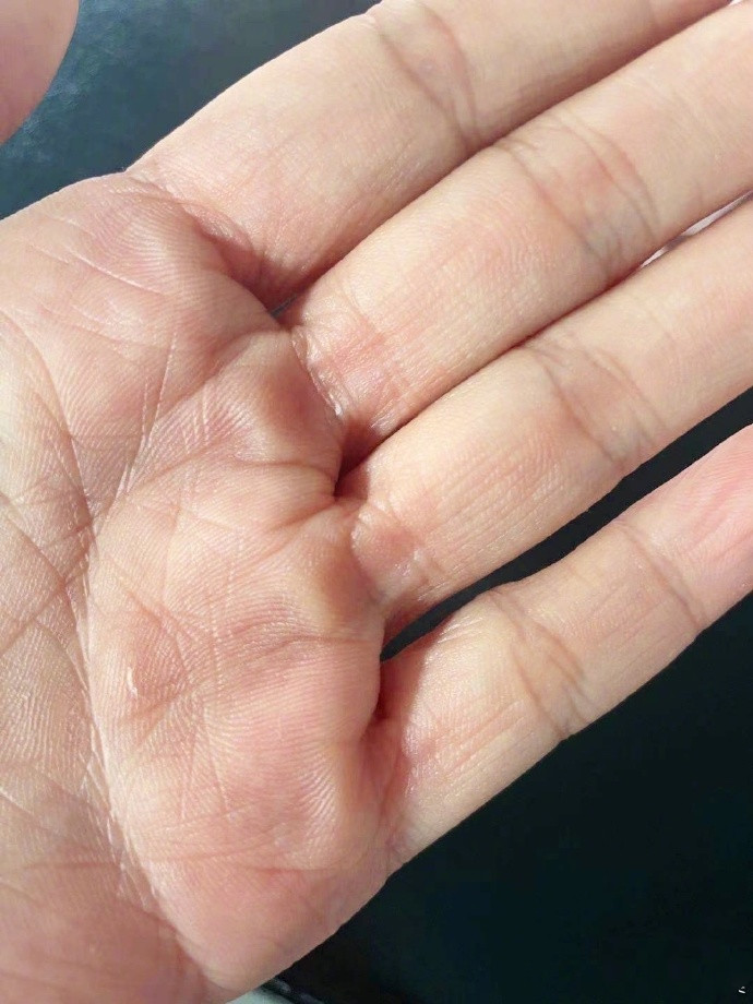 黄奕晒倒立健身照为身材练出满手茧子直呼我是妇女我光荣