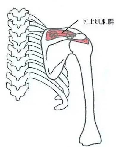 9.冈上肌肌腱压痛点