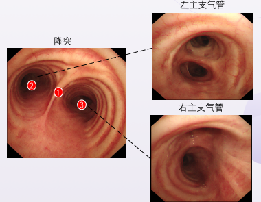 一文教你鏡下分辨各級支氣管!_騰訊新聞