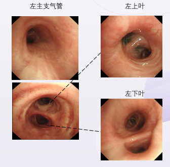 终末细支气管高倍镜图片