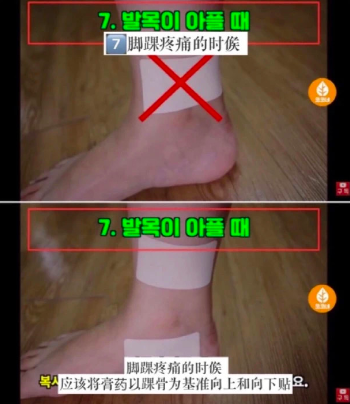 哪儿痛贴哪儿 医生 贴了这么多年的膏药 很多人都没搞对 腾讯网