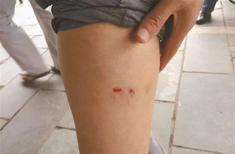 狗突然咬人预示着什么,到底是何原因