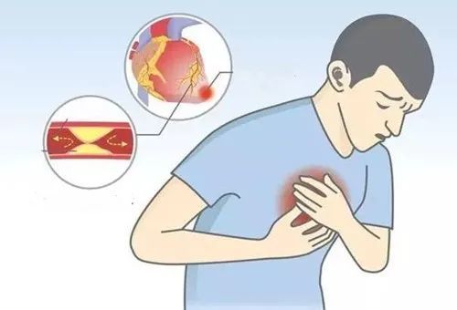 出现心慌心悸怎么办这些方法可缓解