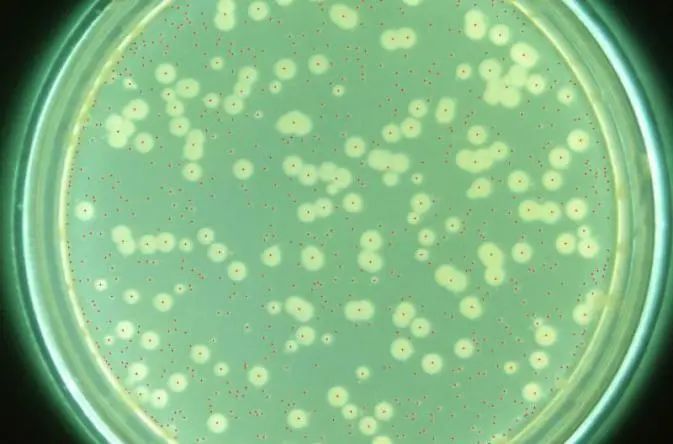 「并不是所有慢阻肺的病人都容易感染铜绿假单胞菌,易感染的主要是