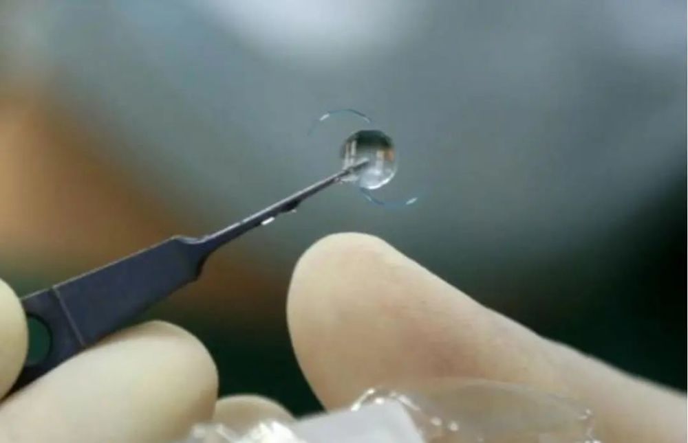 国产人工角膜或于今年6月用于临床价格仅为进口十分之一