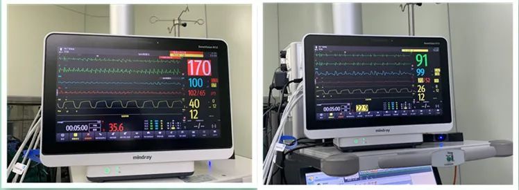 病毒性心肌炎|桂林一女大学生心跳骤停进了ICU！什么情况？