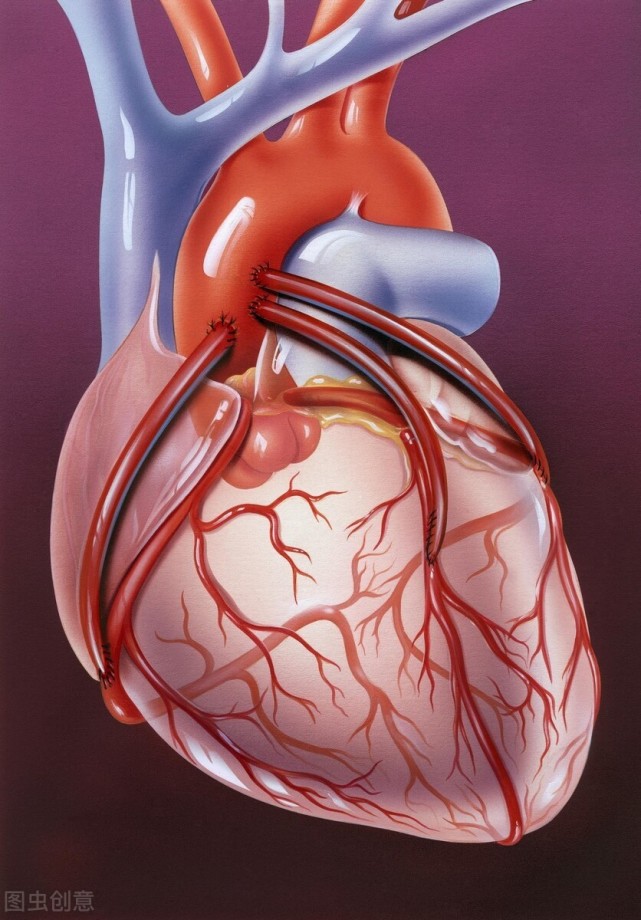 成功冠脉搭桥的冠心病老人 却死于急性肾衰 不可小觑的高尿酸 腾讯新闻