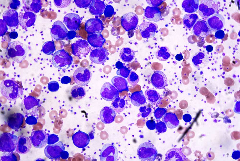 贫血|贫血的人通常会伴随有哪些异常表现？这3个健康常识，请牢记于心