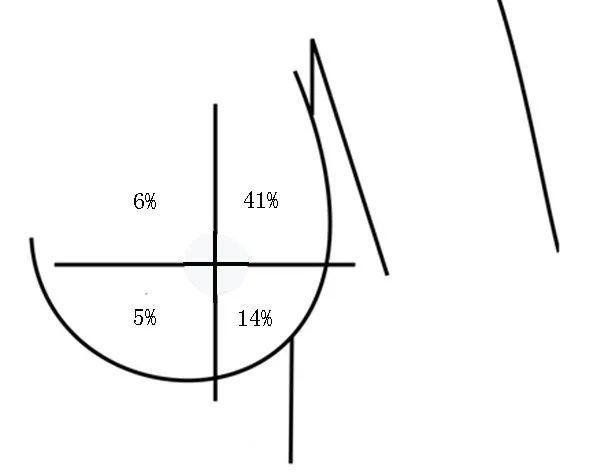 差不多有一半的乳腺癌發生在乳房的外上象限至腋窩部分.