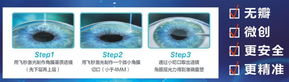 近视手术3个月视力1 2的我 分享下上海近视手术选手术 选医生及费用 腾讯新闻