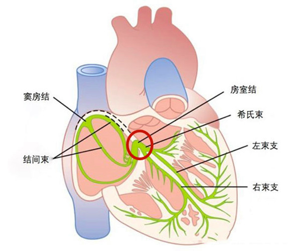 窦房结的位置图片图片