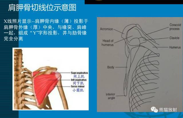 岡上肌之上有三角肌和斜方肌2座