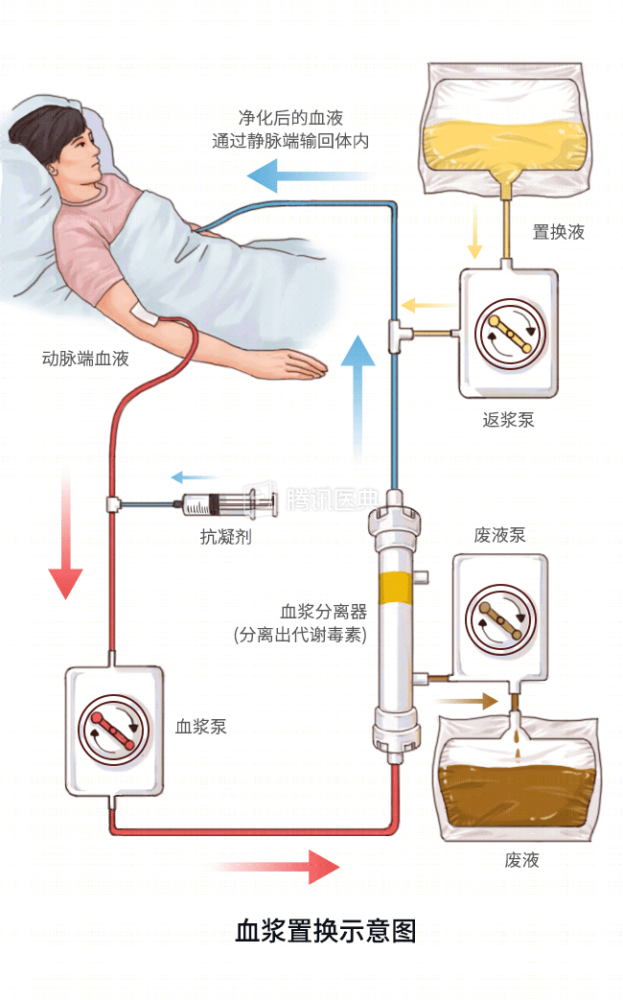 静脉注射循环过程图片