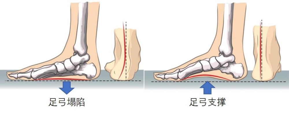 老人鞋|较真丨买“老人鞋”还有这么多讲究？子女们长点心，可别买错了