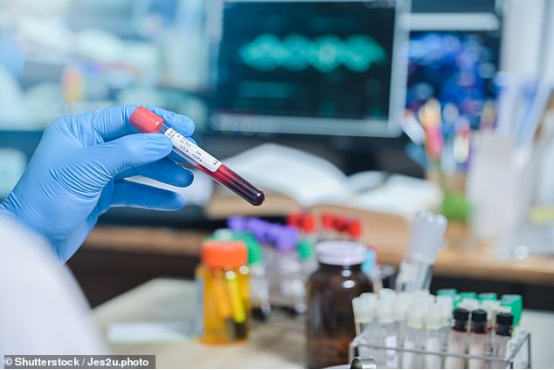 人类免疫缺陷病毒|阿根廷一女子感染艾滋病毒8年后自然治愈 为全球第二例