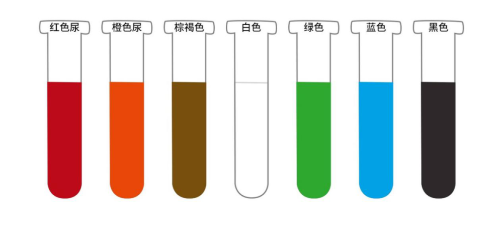 尿液|尿液是淡黄色还是透明色？色号不同，你的健康程度不一样