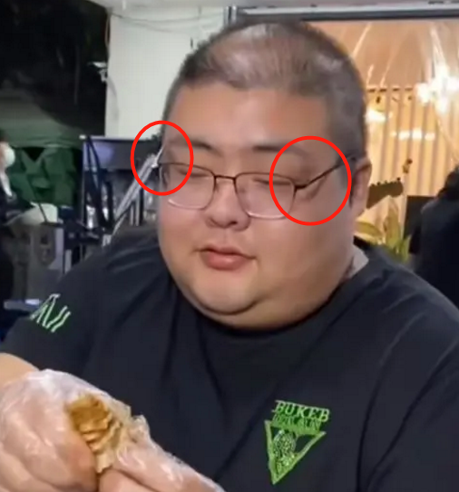 网红泡泡龙去世被恶意造谣和脸上"尸斑"有关,医生辟谣:或为黑棘皮症