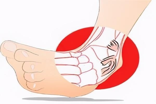 扭伤脚后浙江25岁已婚姑娘发现自己竟然是个男人到底啥情况