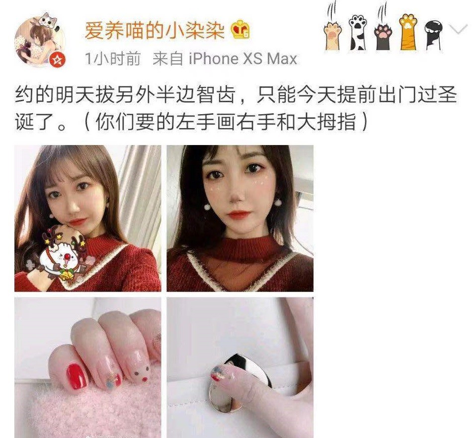 kpl:gemini这次真的过火了?