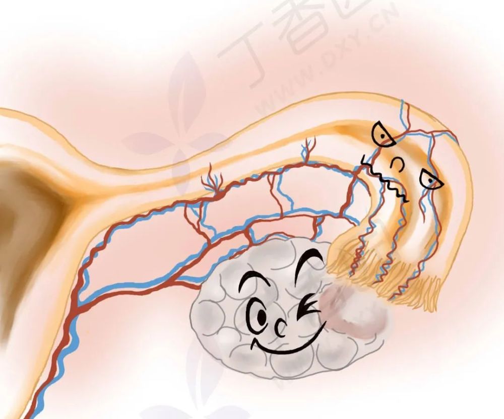 切输卵管是妇产科最简单的手术输卵管不愿意了