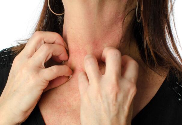 做好这些事皮肤或许会好受些|过敏|花粉|春季皮肤过敏|花粉过敏