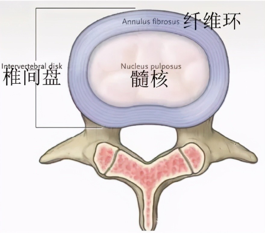 颈腰椎间盘突出后破裂的纤维环还能修复吗