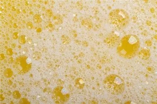 肾病引起的泡沫尿有一定的特点:尿液表面的泡沫比较绵密,且一段时间后