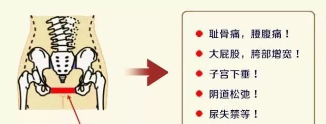 产后修复 骨盆修正 精讲班4月22日在青岛举办 欢迎参加 腾讯新闻