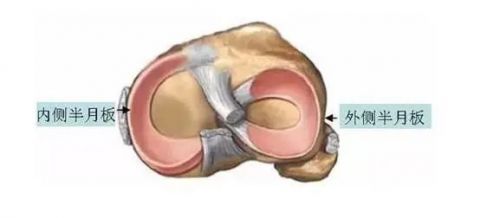 薇娅|薇娅手术照上热搜，医生提醒这种病要小心