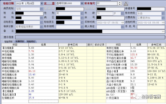 巨幼细胞性贫血|层层推理，一步步揭开你的面纱！