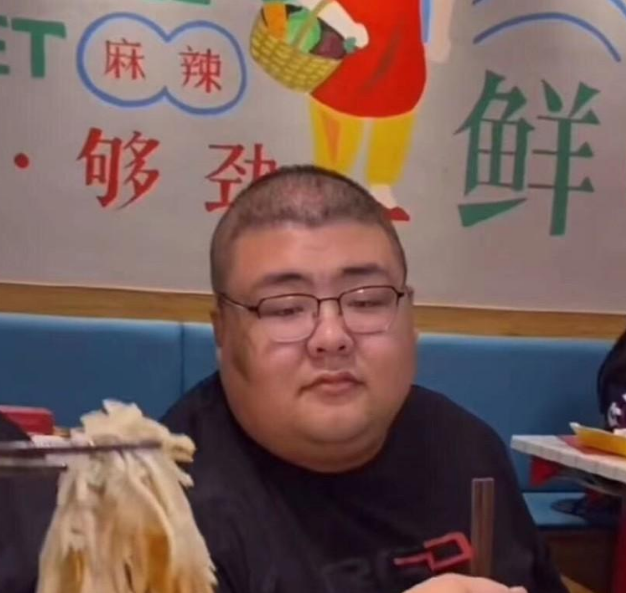 网红泡泡龙去世生前脸部的黑色斑块真是尸斑说出来别不信