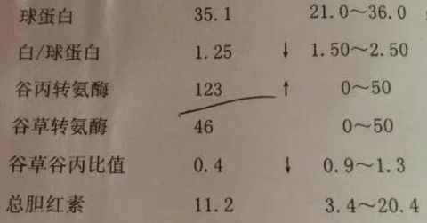 转氨酶|体检报告单中“转氨酶”偏高，意味着什么？看看医生怎么说