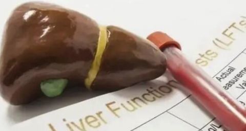 转氨酶|体检报告单中“转氨酶”偏高，意味着什么？看看医生怎么说