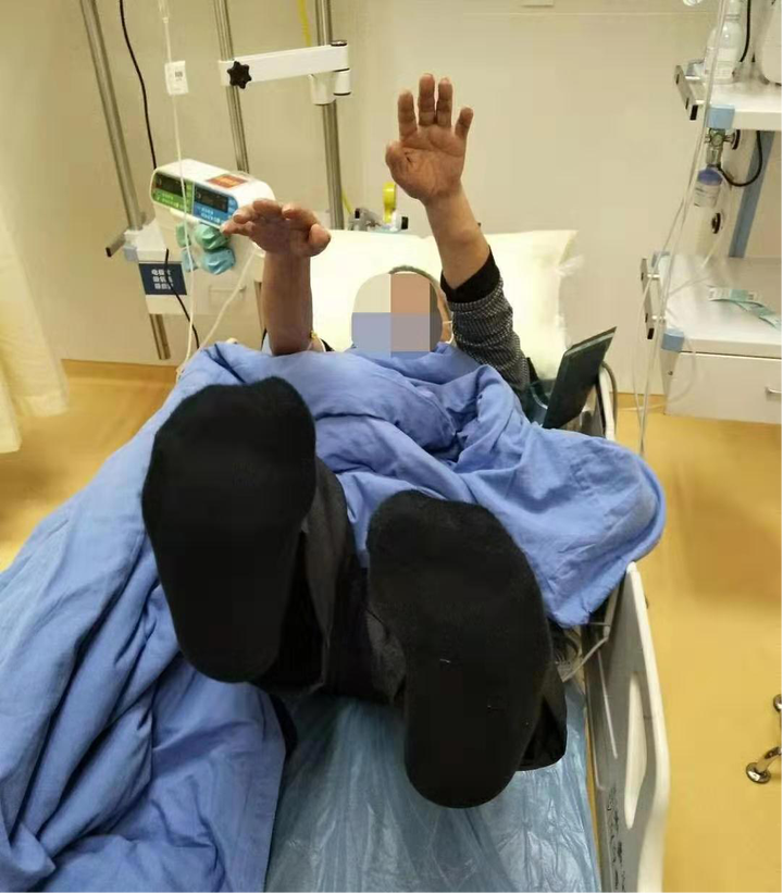 中风|杭州65岁大伯突发中风！走路时出现这样的情况，千万别等等看