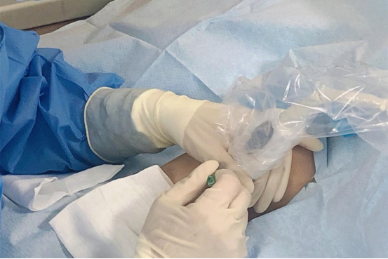 精准定位丨嘉峪关市第一人民医院成功开展超声引导下picc置管术