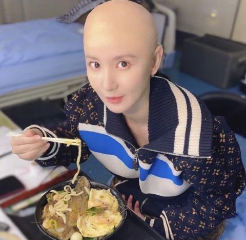 张萌医院晒光头照自侃龙抬头人家剪发我光头