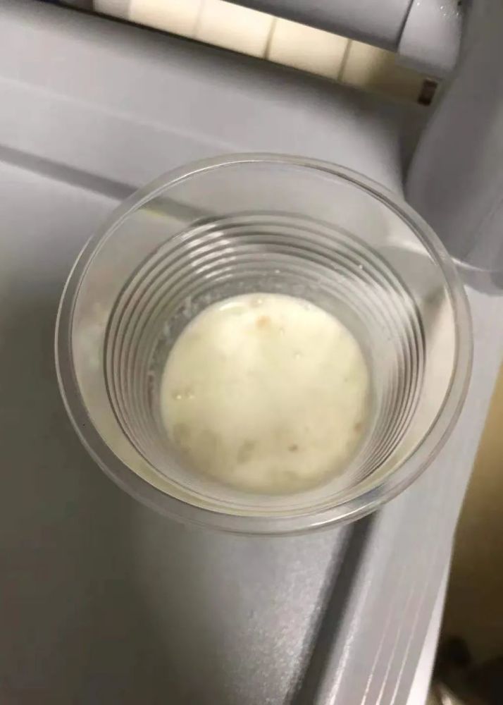 误吃一口顺德一幼儿进了icu这东西很多家庭都有