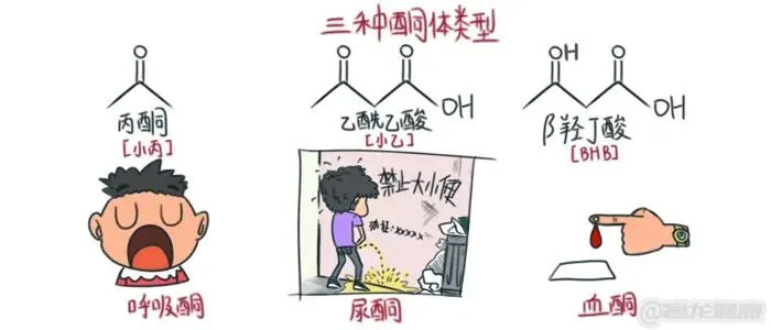 阿尔茨海默病|最新发现：老年痴呆可能有救了｜生酮饮食，治疗阿尔兹海默症