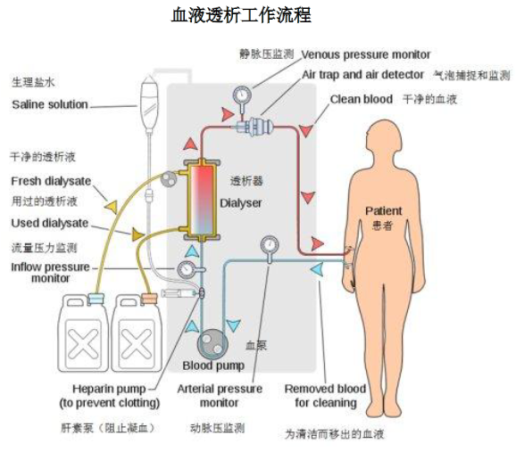 21年中国血液透析行业市场现状及发展前景预测分析 图 腾讯新闻