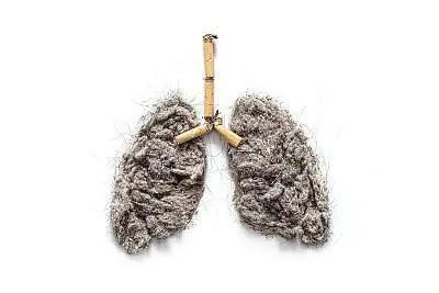 肺癌|男子一天一包烟20年，戒烟一年后离世，身体出现4个信号，别忽视