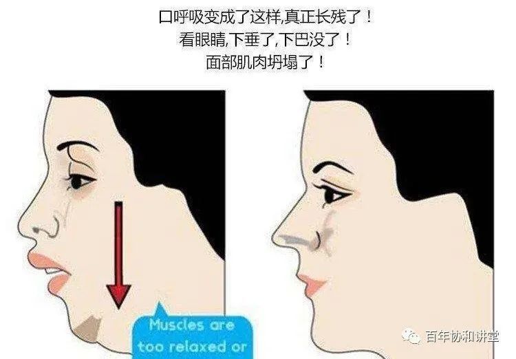 过敏性鼻炎|科学防治鼻塞、鼻痒、涕流不止的过敏性鼻炎