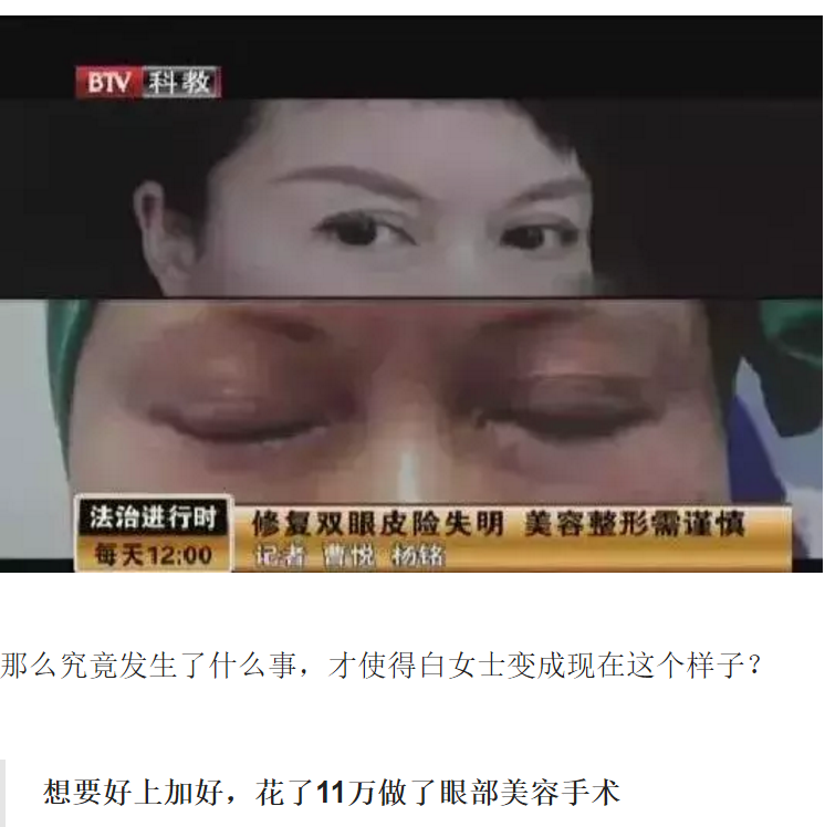 孙雨涵|女子医美毁容被亲友嫌弃，几年不敢见人，涉事医生自称整形大师弟子