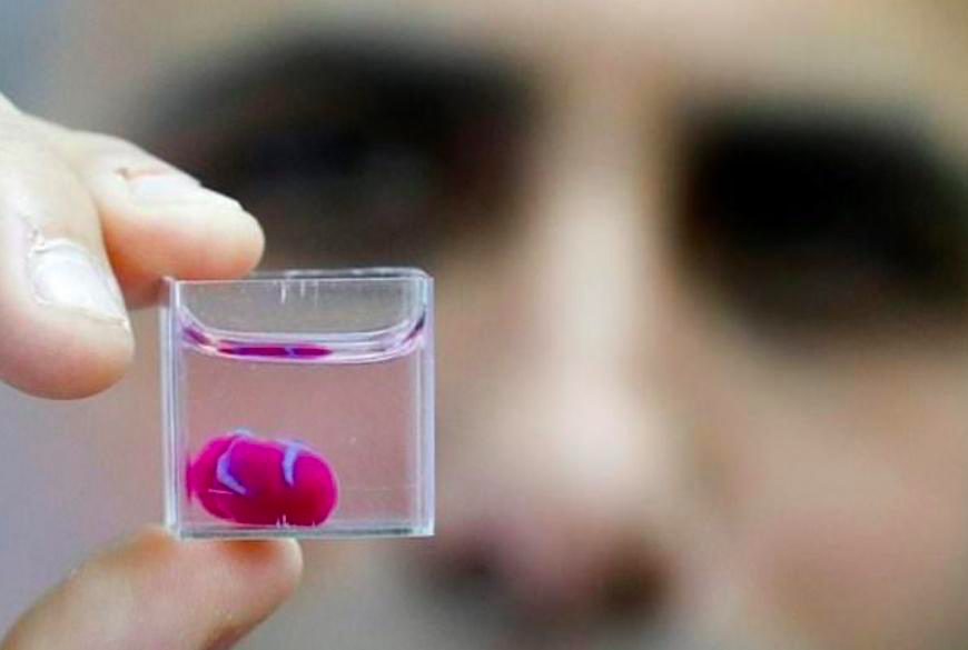 加拿大|79岁加拿大富商被捕：诱骗7000少女，飞中国打亿元针