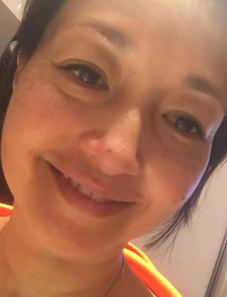 李绮红晒近照皮肤发油发黄还有老年斑才51岁比普通人都要老