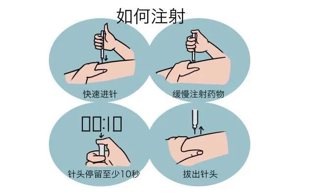 胰岛素注射方式,图解,快收藏_腾讯新闻