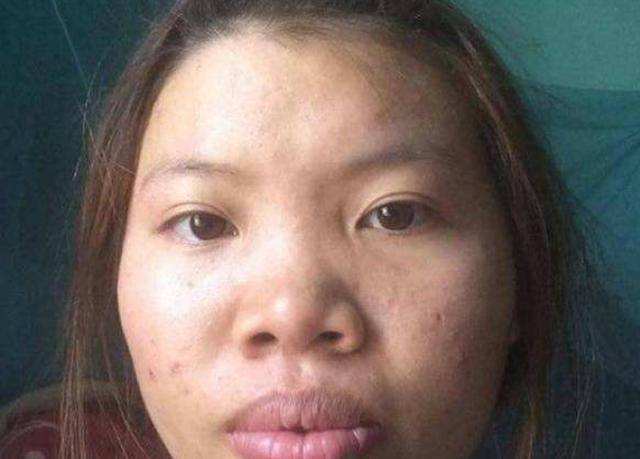 越南"凤姐"为爱整容,嫁给富二代,不料生下一女奇丑无比|整容|郭金凤