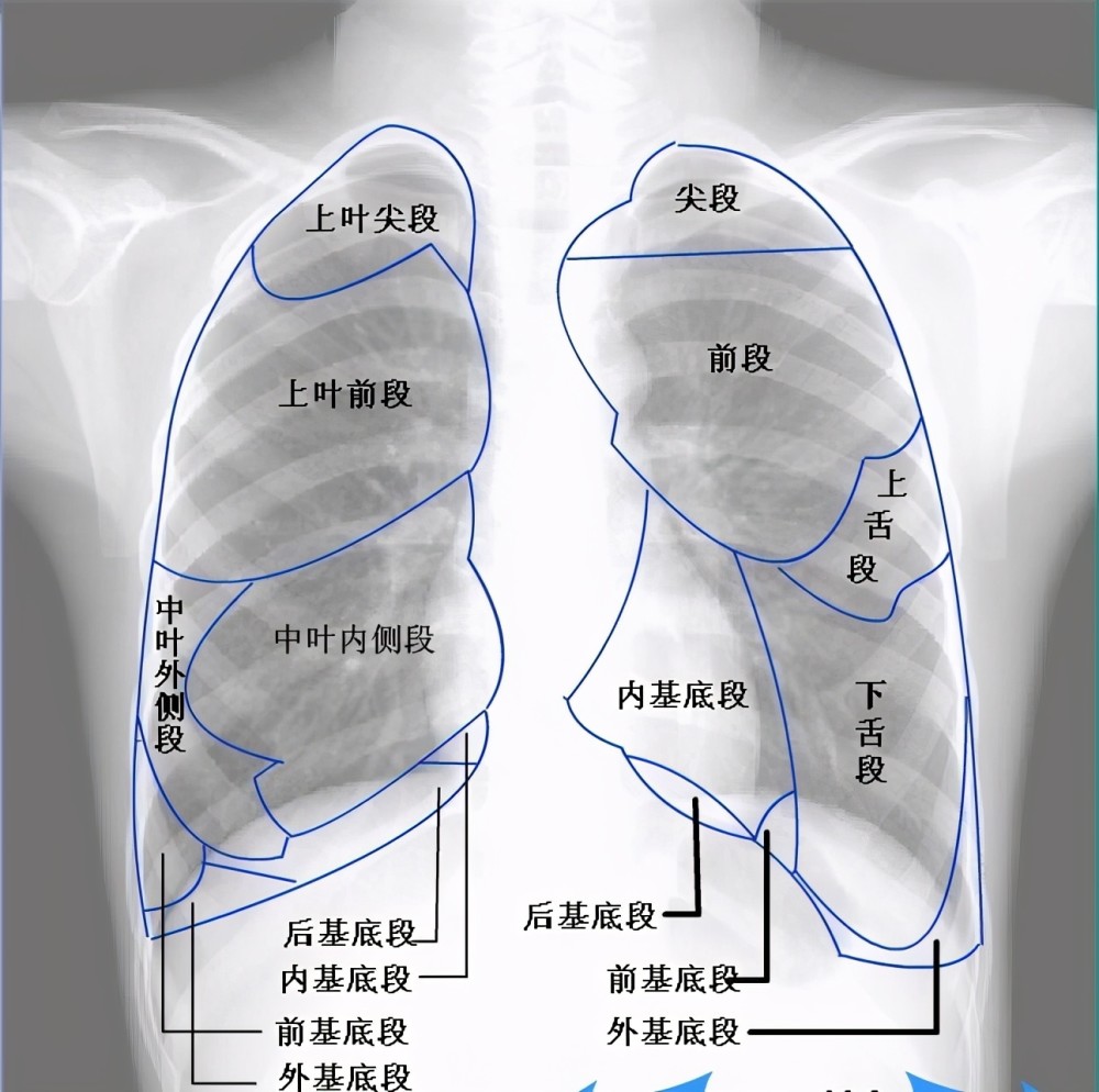 左肺上叶尖后段位置图片